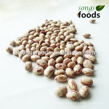 Kidney Buyer,Different Types Dried Beans